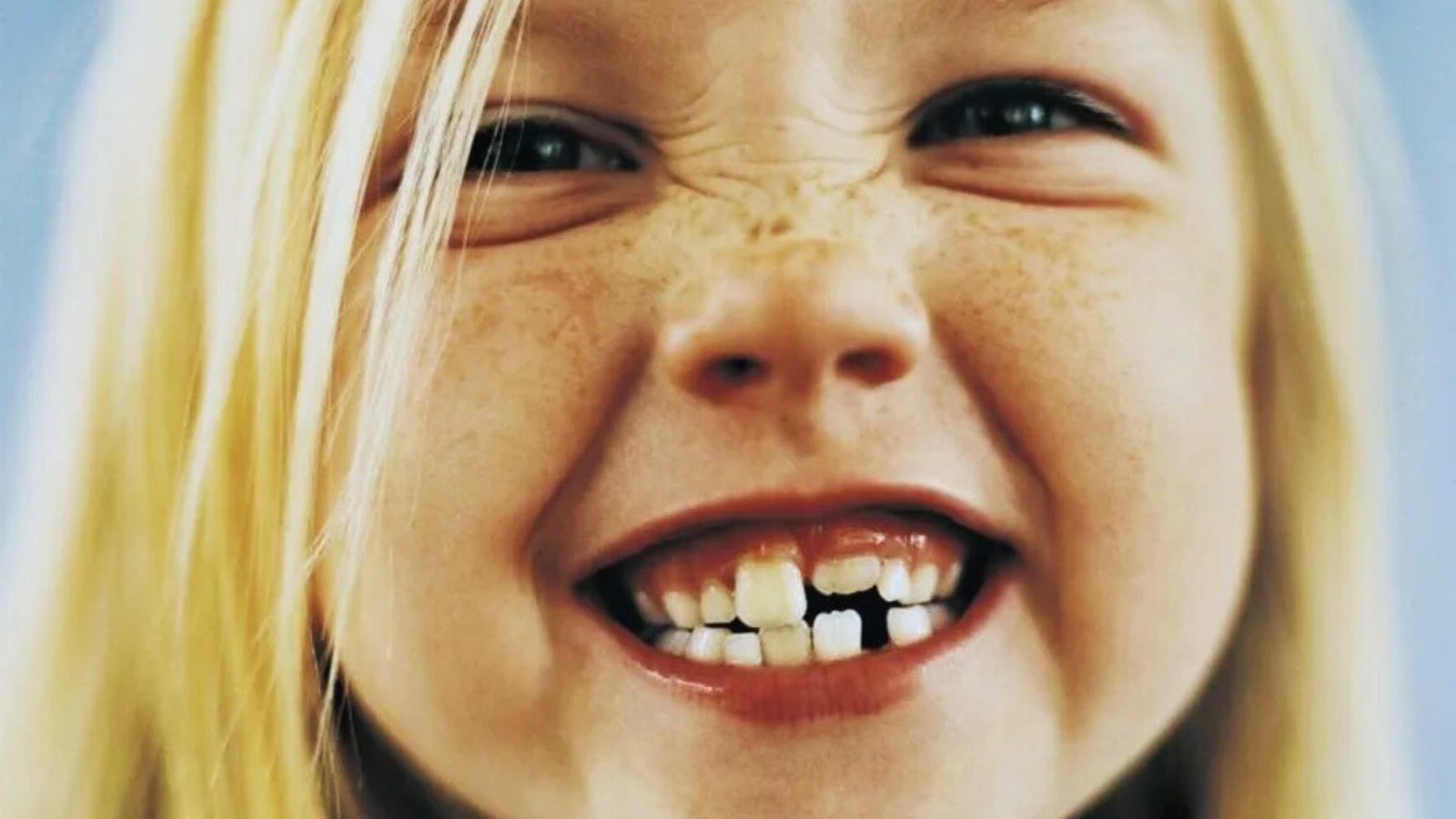 A young girl smiling, showing a gap where a tooth is missing, illustrating childhood dental changes.
