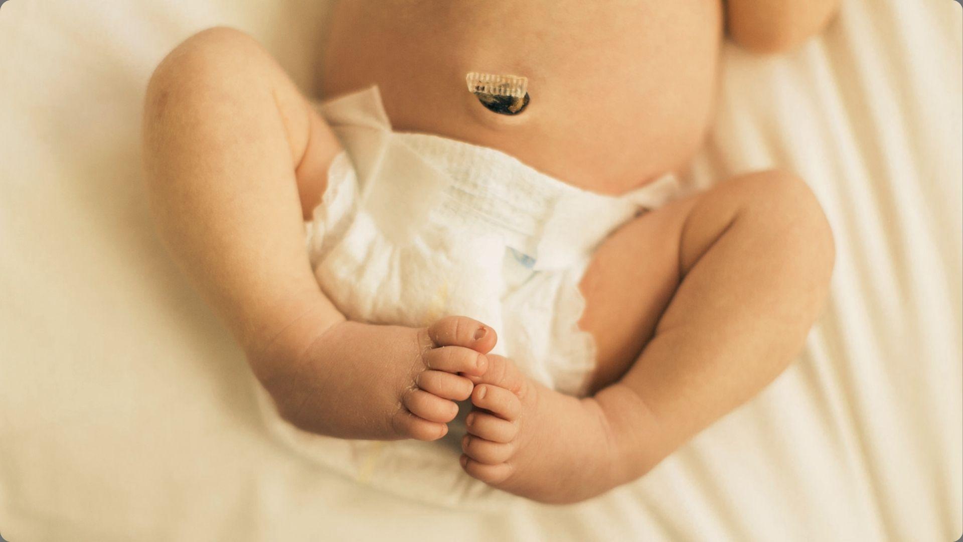 Baby in diaper lying on back showing small healing belly button with dark dried umbilical cord remnant