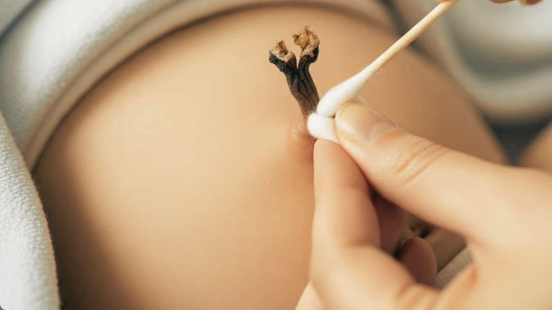 Close-up of newborn belly with dark dried umbilical cord stump being cleaned by adult using cotton swab