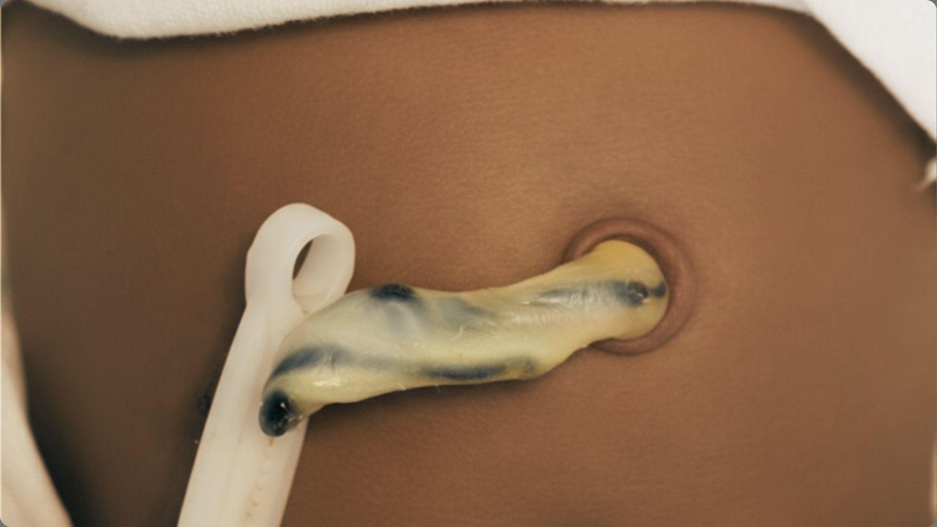 Close-up of newborn baby belly with clamped umbilical cord stump showing blue veins, white plastic clamp attached