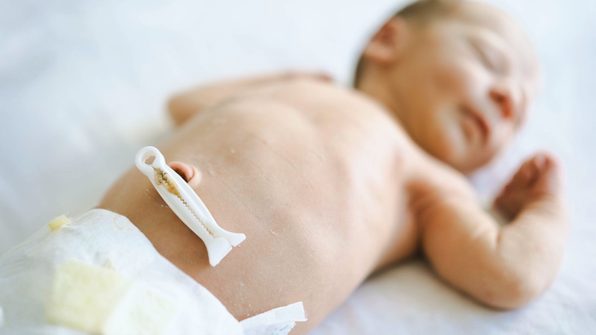 Newborn baby sleeping on back wearing diaper with white umbilical cord clamp on belly