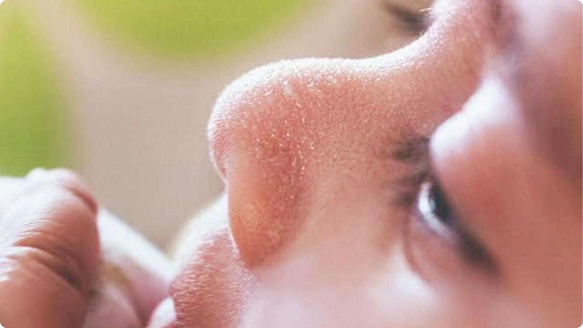 Close-up of baby's sweaty nose with tiny droplets, showing when infants begin sweating to cool down.