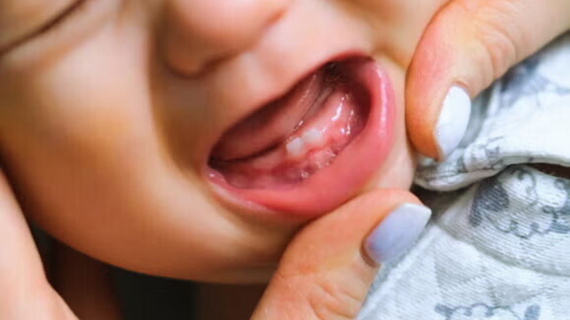 Close-up of baby's open mouth showing lower emerging teeth while adult hands gently hold the cheek