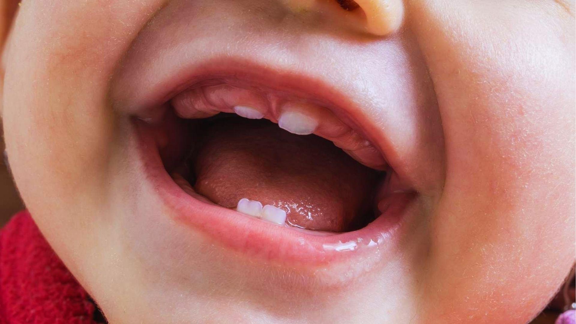 Close-up of a baby’s teeth in development phase