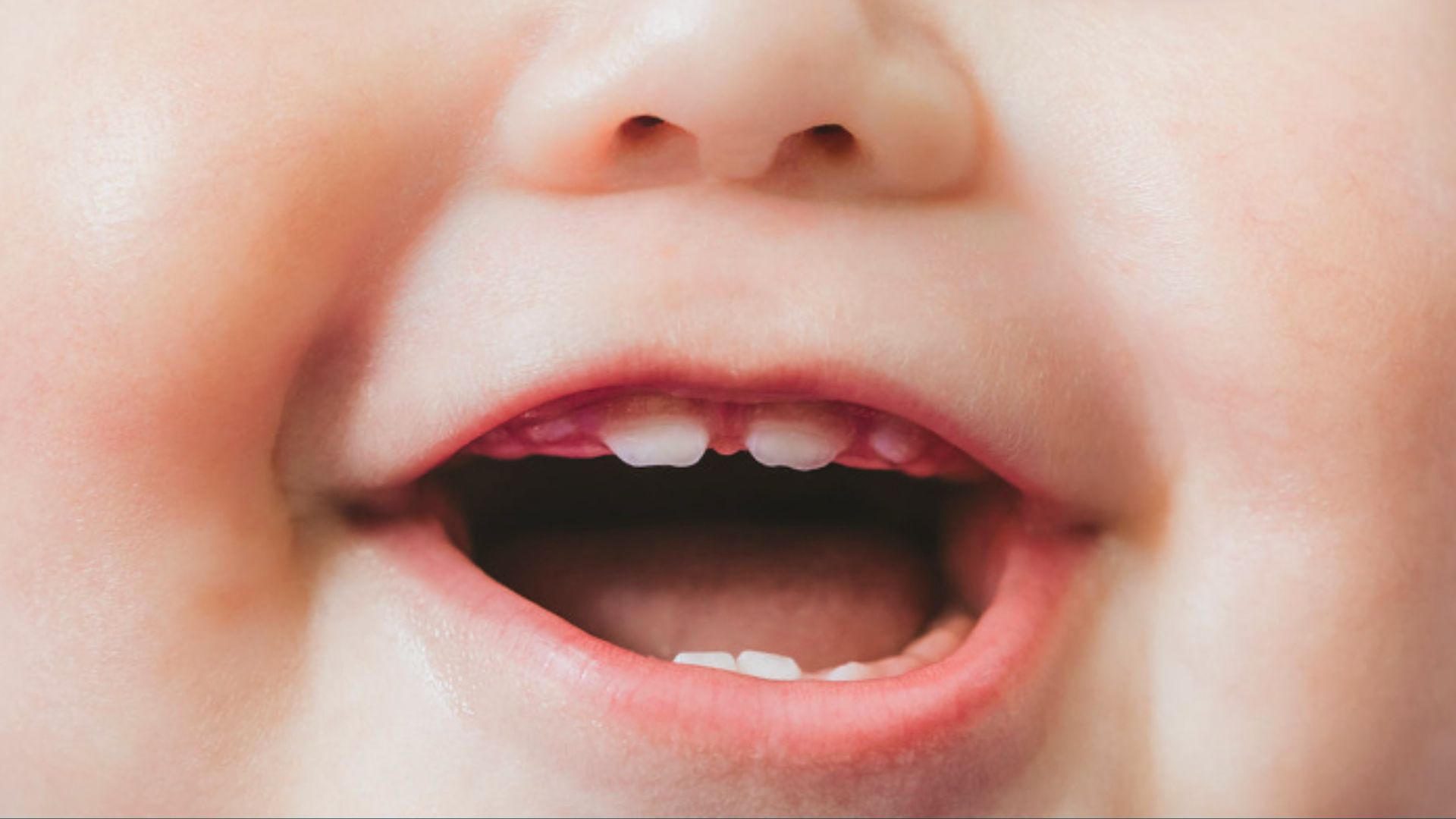 Close-up of baby smiling with open mouth showing two upper and lower baby teeth