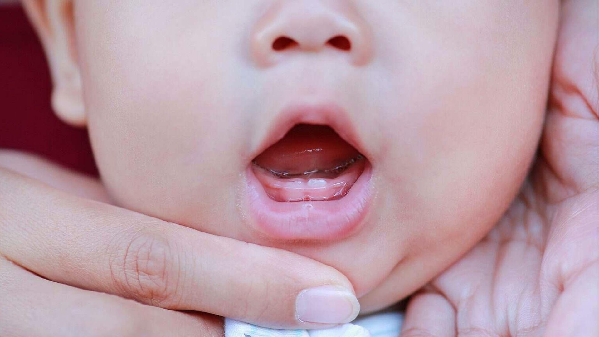 Adult hands holding baby's face, open mouth revealing lower gums.