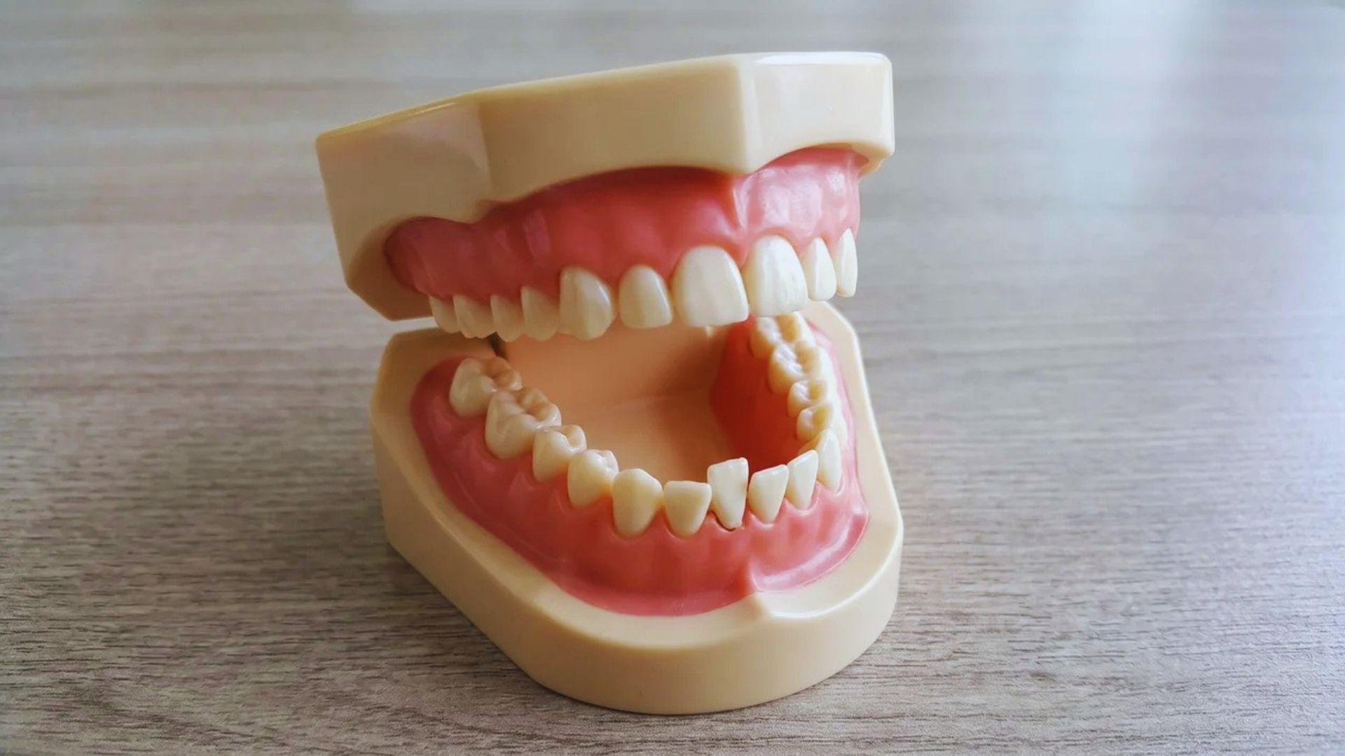 Dental model showing baby teeth, a lower front tooth, and permanent molars.