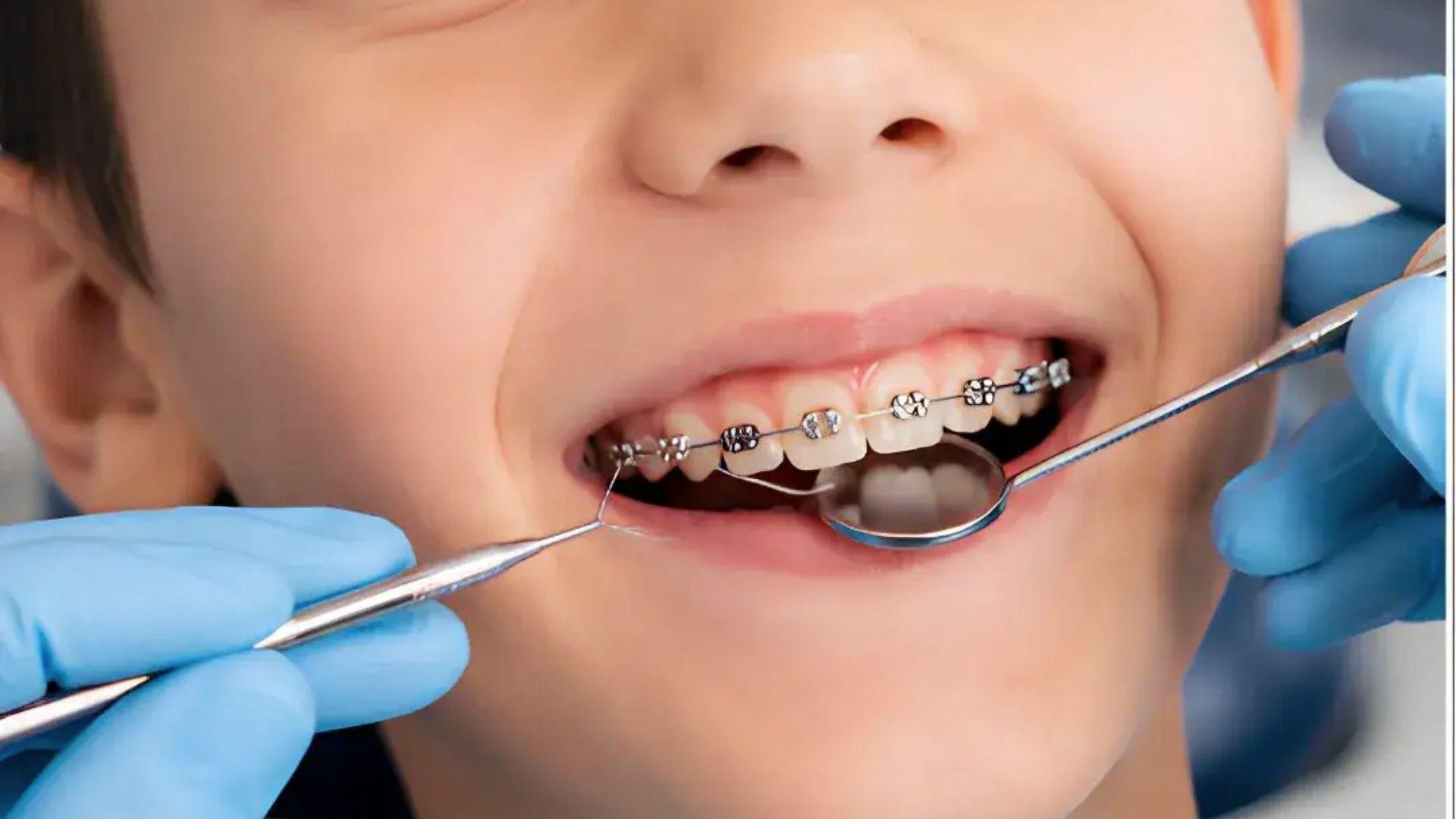 Dentist examining child’s metal braces closely, showing kids orthodontic treatment.