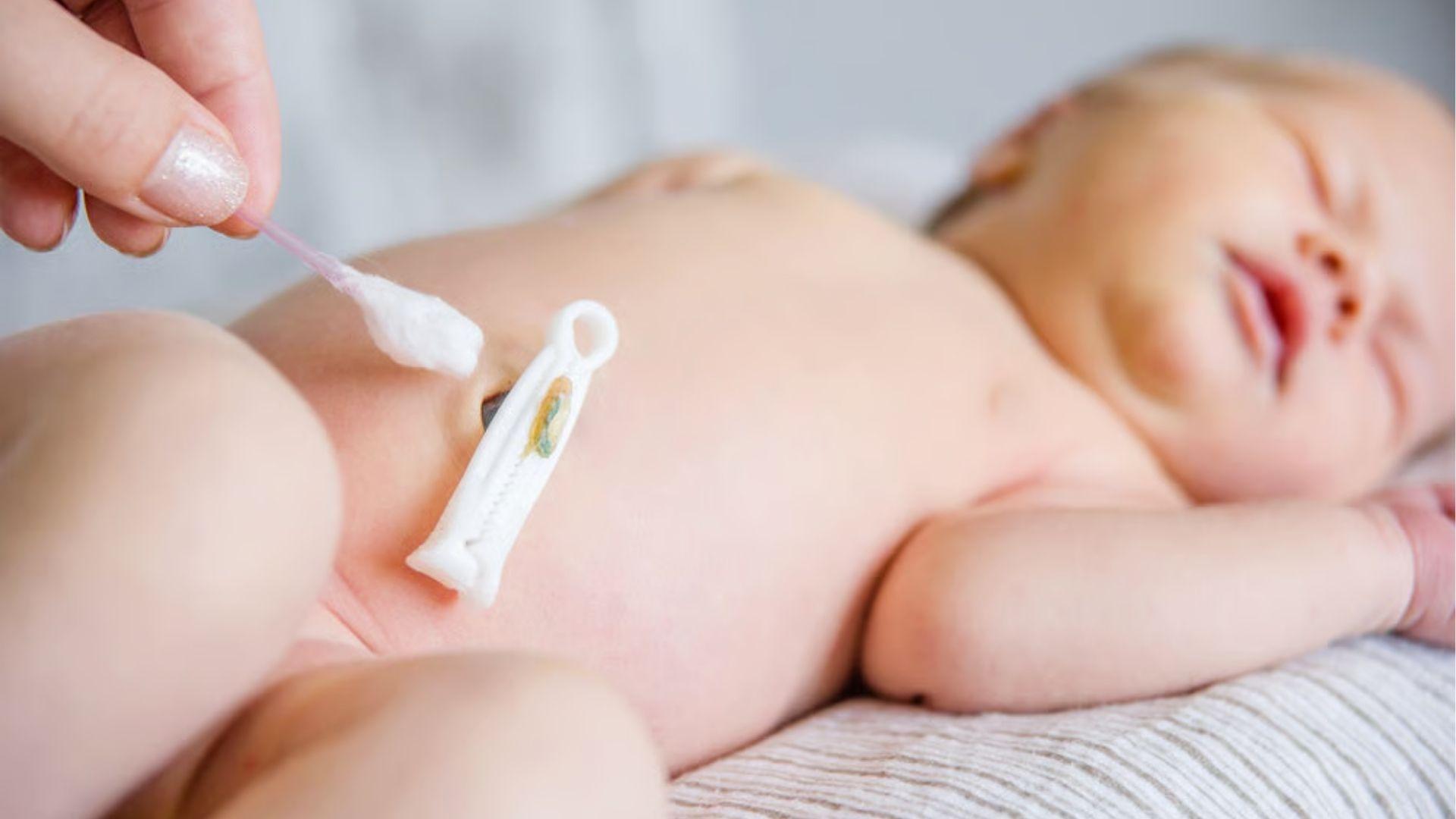 Baby with umbilical cord clamp being cleaned with cotton swab for proper care.