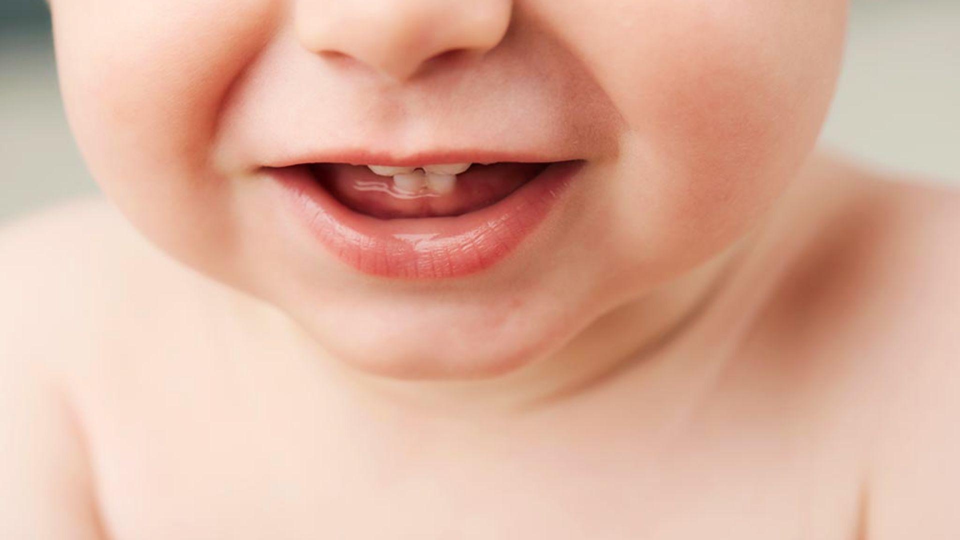 Close-up of baby mouth with upper natal teeth visible.
