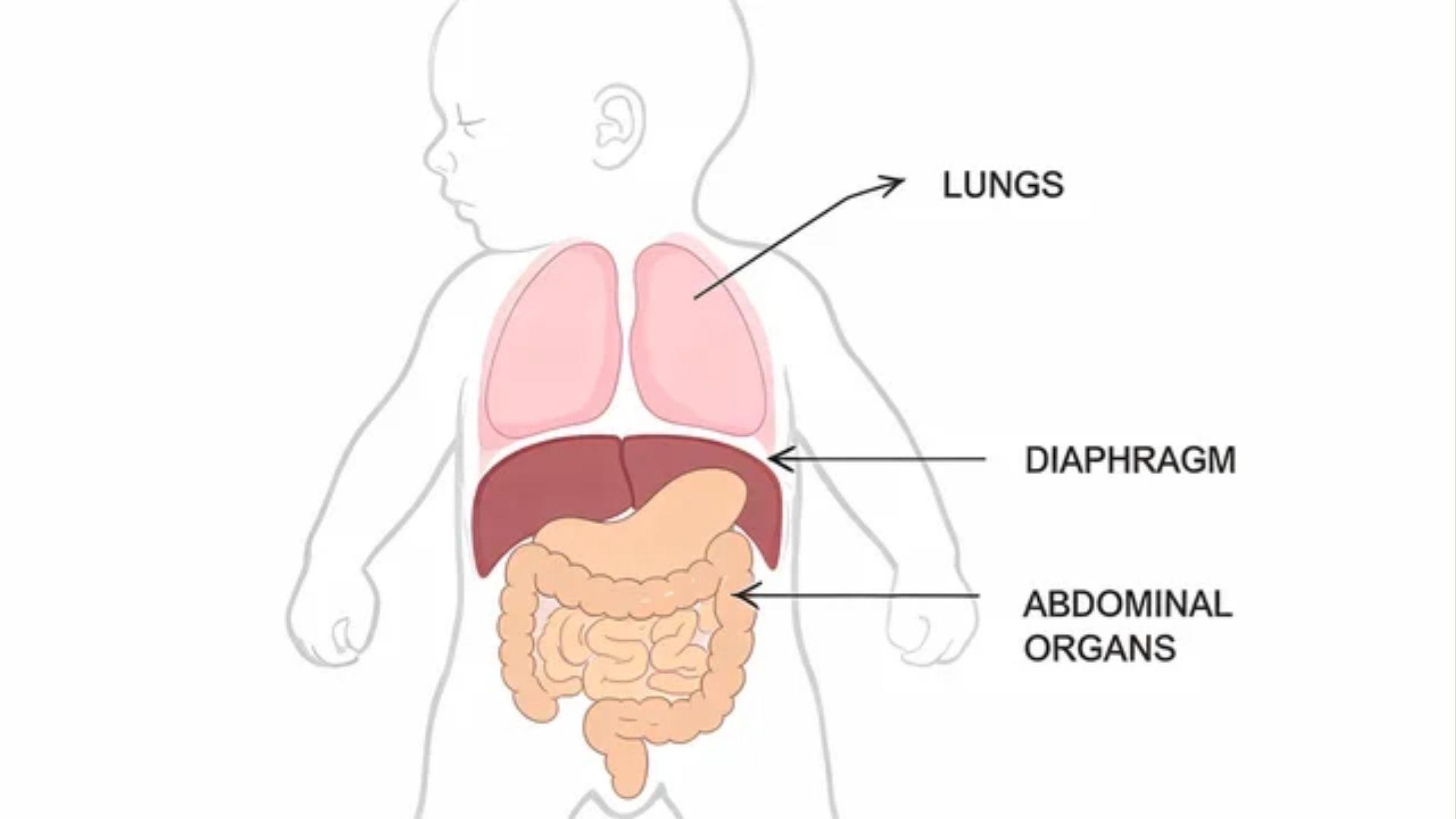 Newborn torso cutaway showing the lungs, diaphragm, and abdominal organs