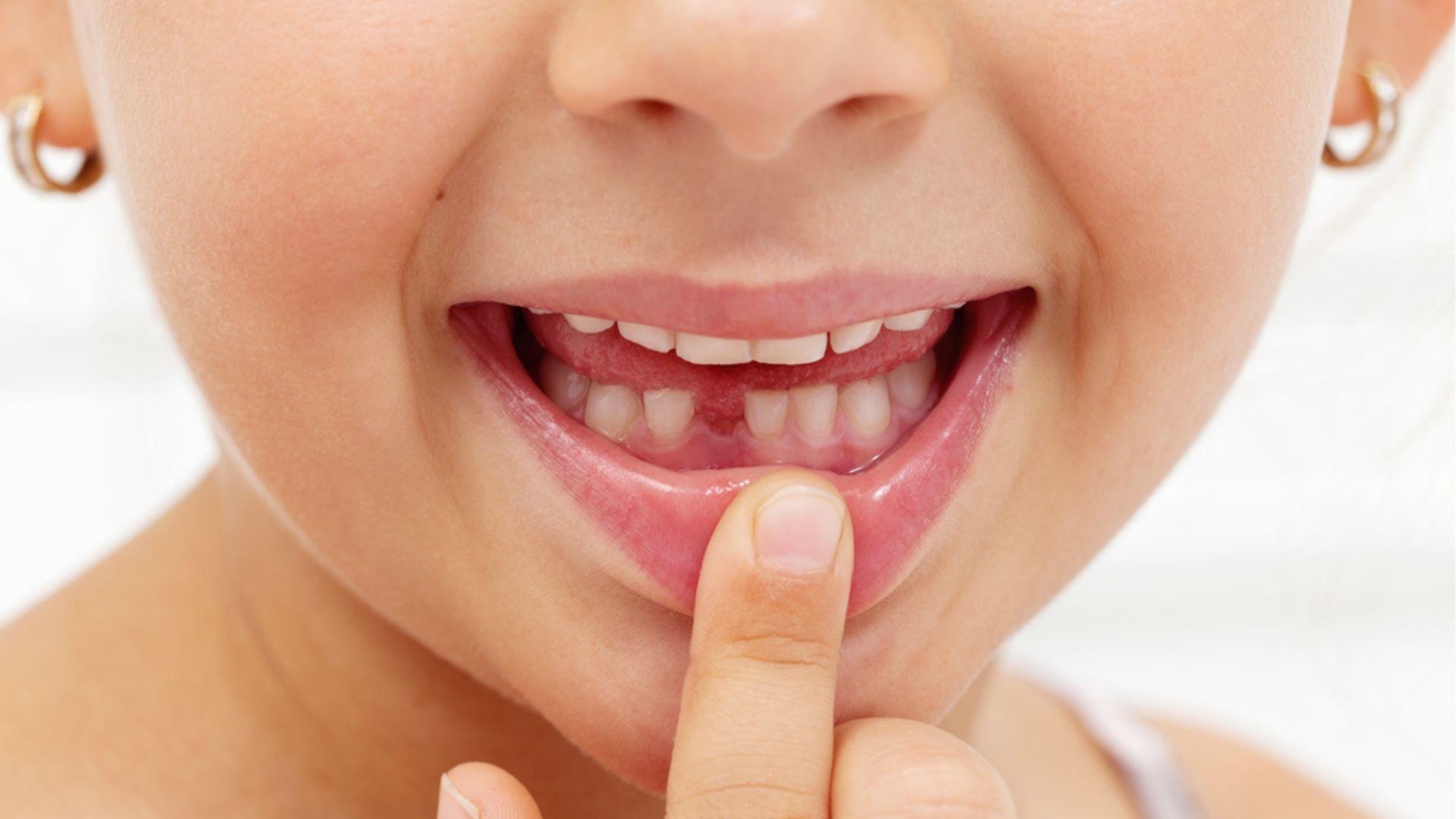 Young girl shows missing lower tooth.