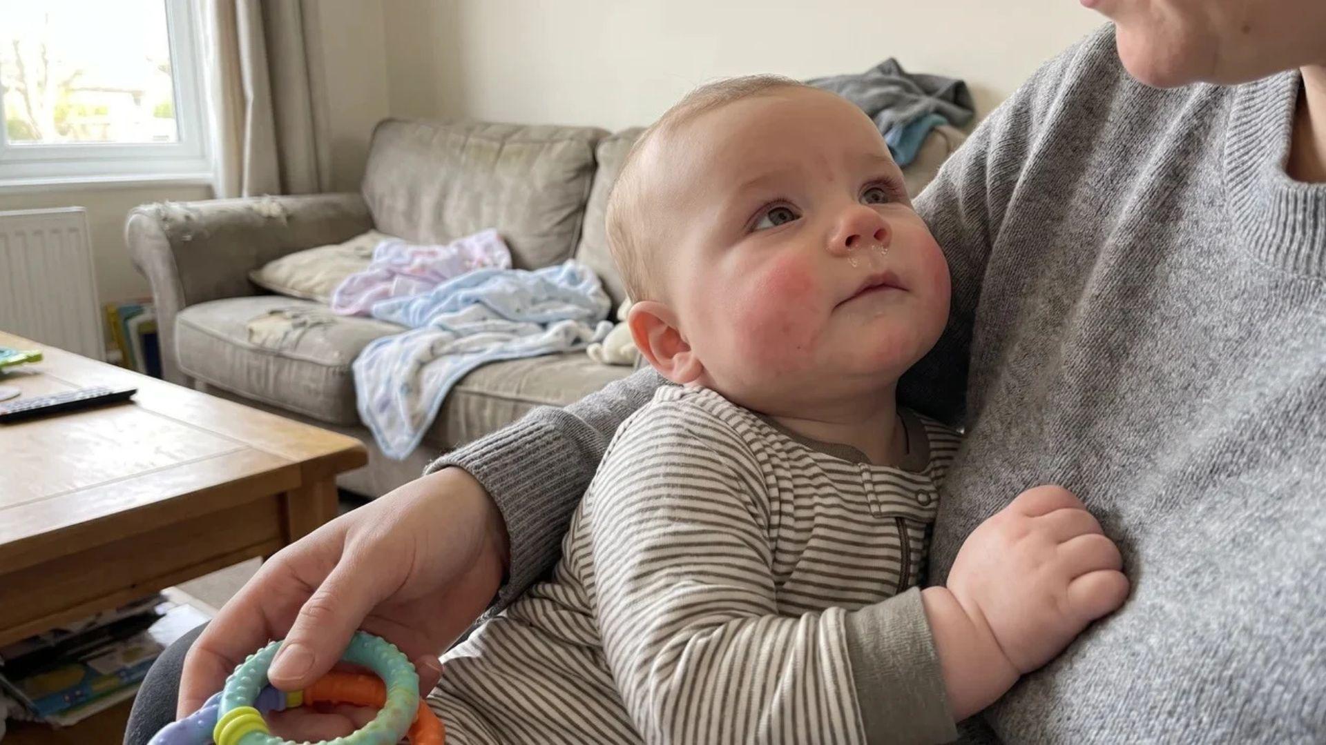 Parent holding a baby with a slightly runny nose and a teething ring nearby.