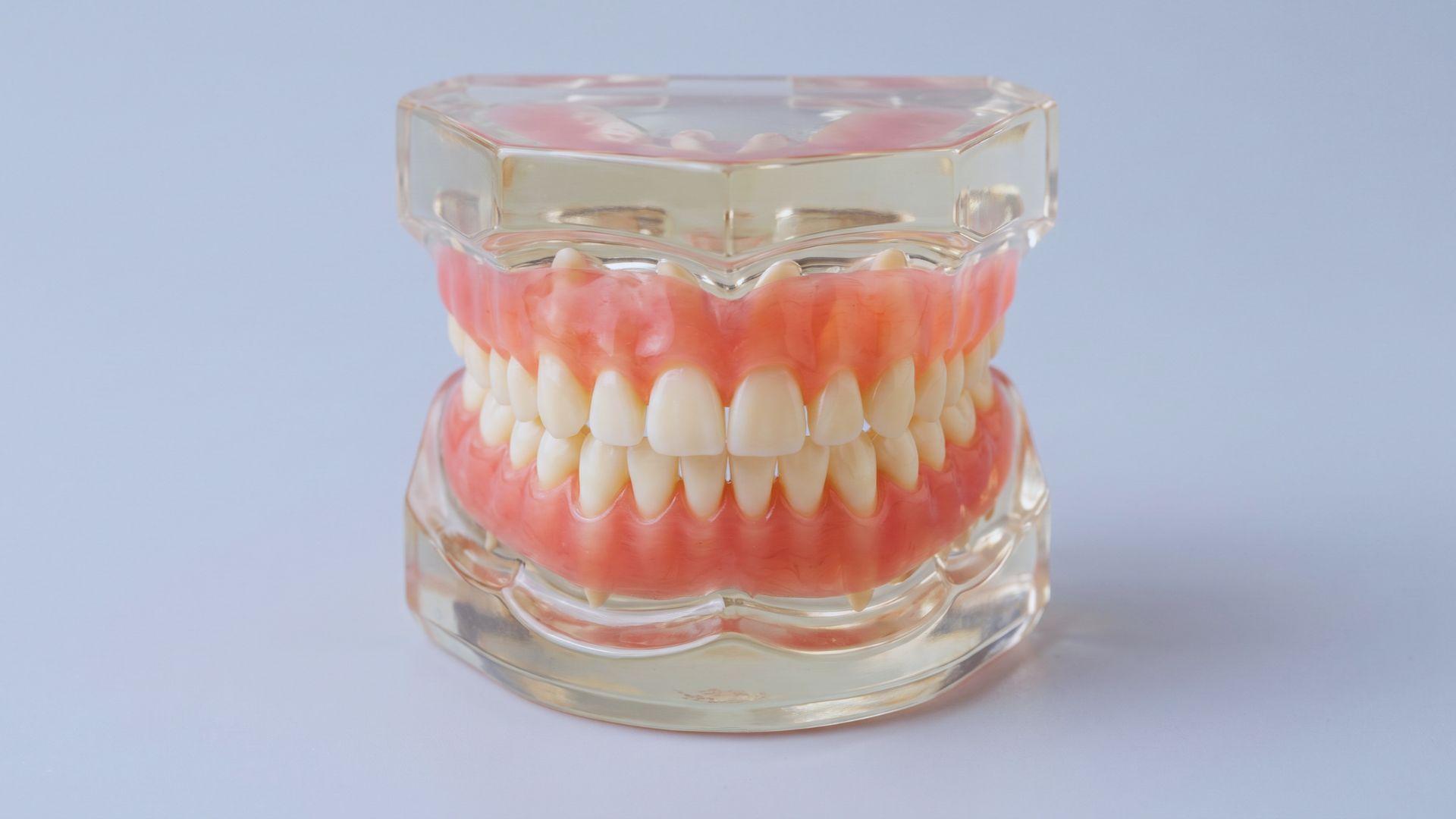 Dental model showing the flat incisors, pointed canines, and broad molars in a primary set.