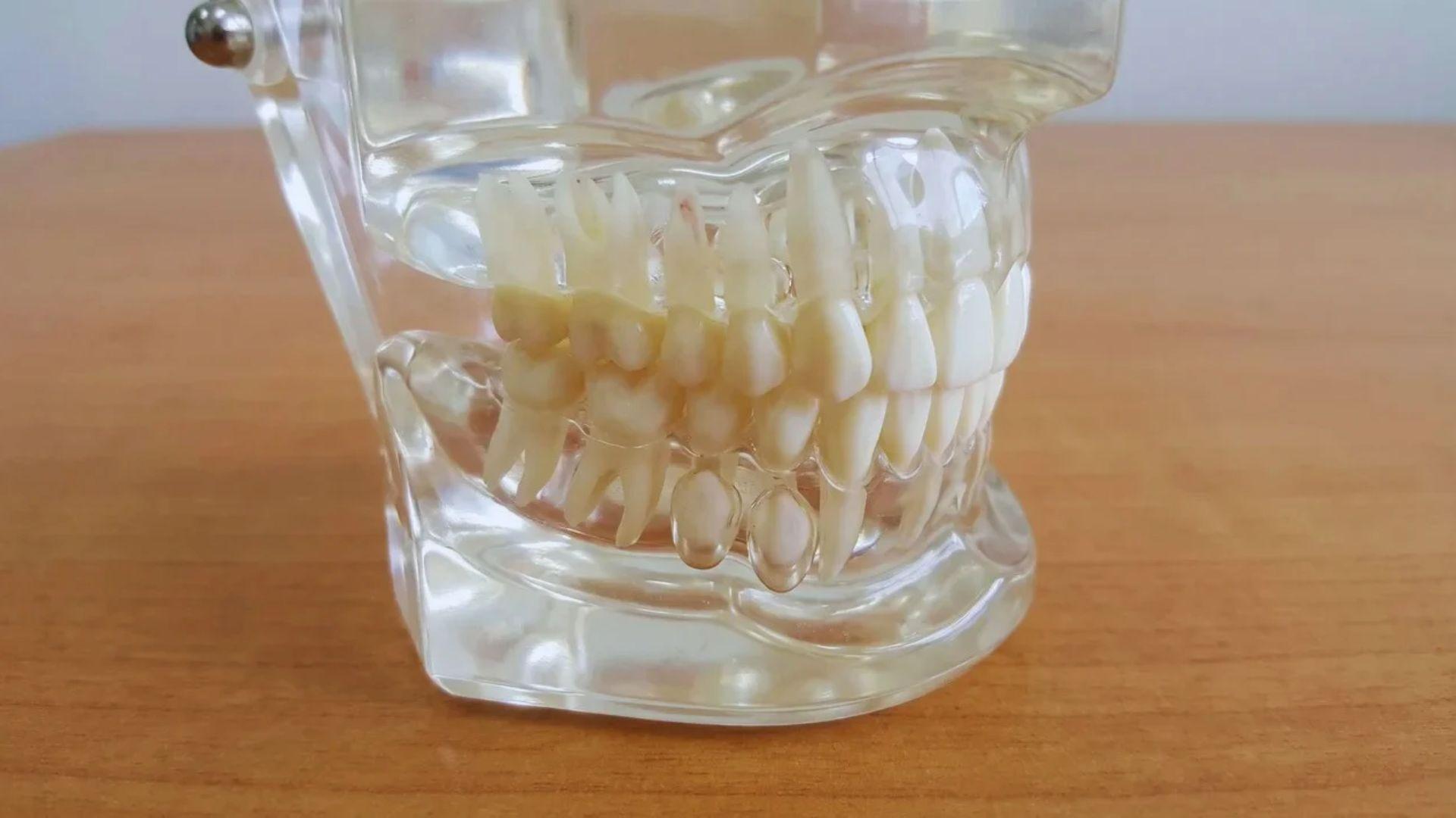 Dental model showing primary teeth above developing permanent teeth.